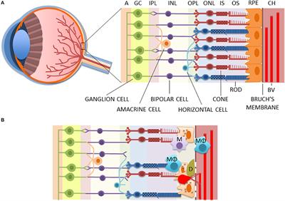 Potential Role of Myeloid-Derived Suppressor Cells (MDSCs) in Age-Related Macular Degeneration (AMD)